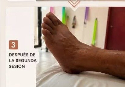Después de la segunda sesión